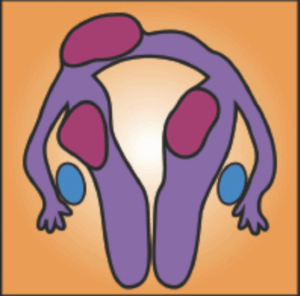 자궁과 자궁근종의 발생 위치를 보여주는 일러스트 그림